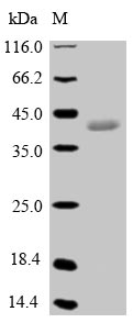 (Tris-Glycine gel) Discontinuous SDS-PAGE (reduced) with 5% enrichment gel and 15% separation gel.