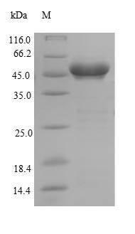 (Tris-Glycine gel) Discontinuous SDS-PAGE (reduced) with 5% enrichment gel and 15% separation gel. (Tris-Glycine gel) Discontinuous SDS-PAGE (reduced) with 5% enrichment gel and 15% separation gel.