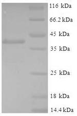 (Tris-Glycine gel) Discontinuous SDS-PAGE (reduced) with 5% enrichment gel and 15% separation gel.