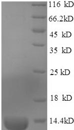 (Tris-Glycine gel) Discontinuous SDS-PAGE (reduced) with 5% enrichment gel and 15% separation gel. (Tris-Glycine gel) Discontinuous SDS-PAGE (reduced) with 5% enrichment gel and 15% separation gel.