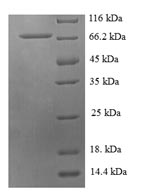 (Tris-Glycine gel) Discontinuous SDS-PAGE (reduced) with 5% enrichment gel and 15% separation gel. (Tris-Glycine gel) Discontinuous SDS-PAGE (reduced) with 5% enrichment gel and 15% separation gel.