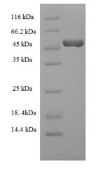(Tris-Glycine gel) Discontinuous SDS-PAGE (reduced) with 5% enrichment gel and 15% separation gel. (Tris-Glycine gel) Discontinuous SDS-PAGE (reduced) with 5% enrichment gel and 15% separation gel.