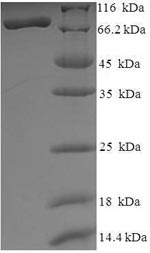 SDS-PAGE- Recombinant protein Human HDAC1