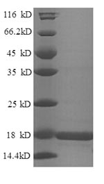 (Tris-Glycine gel) Discontinuous SDS-PAGE (reduced) with 5% enrichment gel and 15% separation gel. (Tris-Glycine gel) Discontinuous SDS-PAGE (reduced) with 5% enrichment gel and 15% separation gel.