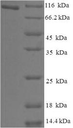 (Tris-Glycine gel) Discontinuous SDS-PAGE (reduced) with 5% enrichment gel and 15% separation gel. (Tris-Glycine gel) Discontinuous SDS-PAGE (reduced) with 5% enrichment gel and 15% separation gel.
