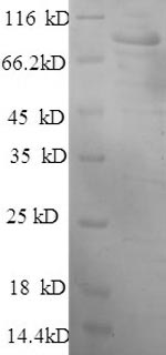 (Tris-Glycine gel) Discontinuous SDS-PAGE (reduced) with 5% enrichment gel and 15% separation gel. (Tris-Glycine gel) Discontinuous SDS-PAGE (reduced) with 5% enrichment gel and 15% separation gel.