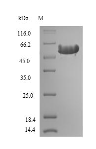 (Tris-Glycine gel) Discontinuous SDS-PAGE (reduced) with 5% enrichment gel and 15% separation gel. (Tris-Glycine gel) Discontinuous SDS-PAGE (reduced) with 5% enrichment gel and 15% separation gel.
