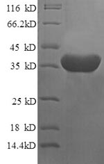 (Tris-Glycine gel) Discontinuous SDS-PAGE (reduced) with 5% enrichment gel and 15% separation gel. (Tris-Glycine gel) Discontinuous SDS-PAGE (reduced) with 5% enrichment gel and 15% separation gel.