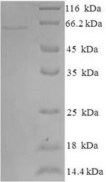 (Tris-Glycine gel) Discontinuous SDS-PAGE (reduced) with 5% enrichment gel and 15% separation gel. (Tris-Glycine gel) Discontinuous SDS-PAGE (reduced) with 5% enrichment gel and 15% separation gel.