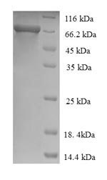 (Tris-Glycine gel) Discontinuous SDS-PAGE (reduced) with 5% enrichment gel and 15% separation gel. (Tris-Glycine gel) Discontinuous SDS-PAGE (reduced) with 5% enrichment gel and 15% separation gel.