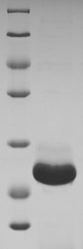 (Tris-Glycine gel) Discontinuous SDS-PAGE (reduced) with 5% enrichment gel and 15% separation gel.