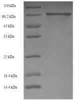 (Tris-Glycine gel) Discontinuous SDS-PAGE (reduced) with 5% enrichment gel and 15% separation gel. (Tris-Glycine gel) Discontinuous SDS-PAGE (reduced) with 5% enrichment gel and 15% separation gel.