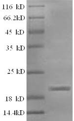 (Tris-Glycine gel) Discontinuous SDS-PAGE (reduced) with 5% enrichment gel and 15% separation gel. (Tris-Glycine gel) Discontinuous SDS-PAGE (reduced) with 5% enrichment gel and 15% separation gel.
