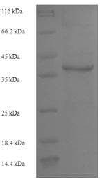 SDS-PAGE- Recombinant protein Human IL2