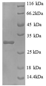 Recombinant Mouse Interleukin-2 receptor subunit beta (Il2rb) , partial - image 1