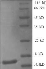 (Tris-Glycine gel) Discontinuous SDS-PAGE (reduced) with 5% enrichment gel and 15% separation gel. (Tris-Glycine gel) Discontinuous SDS-PAGE (reduced) with 5% enrichment gel and 15% separation gel.