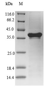 (Tris-Glycine gel) Discontinuous SDS-PAGE (reduced) with 5% enrichment gel and 15% separation gel. (Tris-Glycine gel) Discontinuous SDS-PAGE (reduced) with 5% enrichment gel and 15% separation gel.