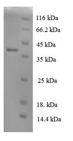 (Tris-Glycine gel) Discontinuous SDS-PAGE (reduced) with 5% enrichment gel and 15% separation gel. (Tris-Glycine gel) Discontinuous SDS-PAGE (reduced) with 5% enrichment gel and 15% separation gel.