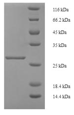 SDS-PAGE- Recombinant protein Human INHBA