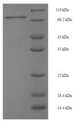 (Tris-Glycine gel) Discontinuous SDS-PAGE (reduced) with 5% enrichment gel and 15% separation gel. (Tris-Glycine gel) Discontinuous SDS-PAGE (reduced) with 5% enrichment gel and 15% separation gel.