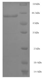 (Tris-Glycine gel) Discontinuous SDS-PAGE (reduced) with 5% enrichment gel and 15% separation gel. (Tris-Glycine gel) Discontinuous SDS-PAGE (reduced) with 5% enrichment gel and 15% separation gel.