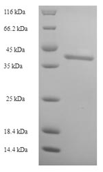 (Tris-Glycine gel) Discontinuous SDS-PAGE (reduced) with 5% enrichment gel and 15% separation gel.