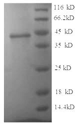 (Tris-Glycine gel) Discontinuous SDS-PAGE (reduced) with 5% enrichment gel and 15% separation gel.