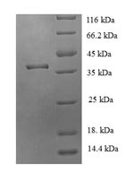 SDS-PAGE- Recombinant protein Human JMJD7