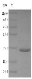 SDS-PAGE- Recombinant protein Brugia JTB