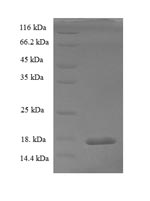 (Tris-Glycine gel) Discontinuous SDS-PAGE (reduced) with 5% enrichment gel and 15% separation gel. (Tris-Glycine gel) Discontinuous SDS-PAGE (reduced) with 5% enrichment gel and 15% separation gel.