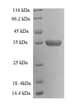 (Tris-Glycine gel) Discontinuous SDS-PAGE (reduced) with 5% enrichment gel and 15% separation gel. (Tris-Glycine gel) Discontinuous SDS-PAGE (reduced) with 5% enrichment gel and 15% separation gel.