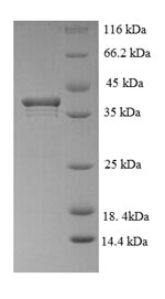 (Tris-Glycine gel) Discontinuous SDS-PAGE (reduced) with 5% enrichment gel and 15% separation gel. (Tris-Glycine gel) Discontinuous SDS-PAGE (reduced) with 5% enrichment gel and 15% separation gel.