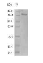 (Tris-Glycine gel) Discontinuous SDS-PAGE (reduced) with 5% enrichment gel and 15% separation gel. (Tris-Glycine gel) Discontinuous SDS-PAGE (reduced) with 5% enrichment gel and 15% separation gel.