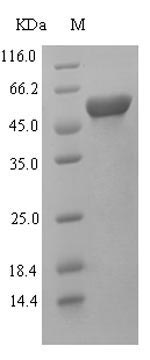 (Tris-Glycine gel) Discontinuous SDS-PAGE (reduced) with 5% enrichment gel and 15% separation gel. (Tris-Glycine gel) Discontinuous SDS-PAGE (reduced) with 5% enrichment gel and 15% separation gel.