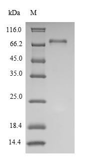 SDS-PAGE- Recombinant protein Human LCK