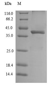 SDS-PAGE- Recombinant protein Mouse Lgmn