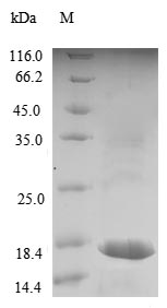 (Tris-Glycine gel) Discontinuous SDS-PAGE (reduced) with 5% enrichment gel and 15% separation gel. (Tris-Glycine gel) Discontinuous SDS-PAGE (reduced) with 5% enrichment gel and 15% separation gel.