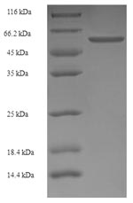 (Tris-Glycine gel) Discontinuous SDS-PAGE (reduced) with 5% enrichment gel and 15% separation gel. (Tris-Glycine gel) Discontinuous SDS-PAGE (reduced) with 5% enrichment gel and 15% separation gel.