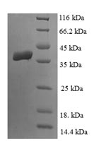 SDS-PAGE- Recombinant protein Human LIAS