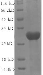 (Tris-Glycine gel) Discontinuous SDS-PAGE (reduced) with 5% enrichment gel and 15% separation gel. (Tris-Glycine gel) Discontinuous SDS-PAGE (reduced) with 5% enrichment gel and 15% separation gel.