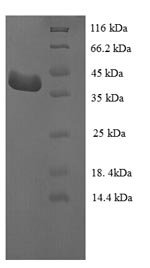 (Tris-Glycine gel) Discontinuous SDS-PAGE (reduced) with 5% enrichment gel and 15% separation gel.