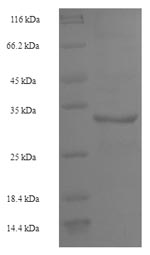 (Tris-Glycine gel) Discontinuous SDS-PAGE (reduced) with 5% enrichment gel and 15% separation gel. (Tris-Glycine gel) Discontinuous SDS-PAGE (reduced) with 5% enrichment gel and 15% separation gel.