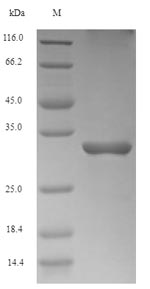 (Tris-Glycine gel) Discontinuous SDS-PAGE (reduced) with 5% enrichment gel and 15% separation gel. (Tris-Glycine gel) Discontinuous SDS-PAGE (reduced) with 5% enrichment gel and 15% separation gel.