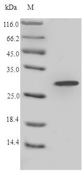 (Tris-Glycine gel) Discontinuous SDS-PAGE (reduced) with 5% enrichment gel and 15% separation gel.
