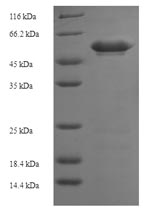(Tris-Glycine gel) Discontinuous SDS-PAGE (reduced) with 5% enrichment gel and 15% separation gel. (Tris-Glycine gel) Discontinuous SDS-PAGE (reduced) with 5% enrichment gel and 15% separation gel.