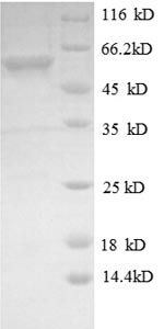 (Tris-Glycine gel) Discontinuous SDS-PAGE (reduced) with 5% enrichment gel and 15% separation gel. (Tris-Glycine gel) Discontinuous SDS-PAGE (reduced) with 5% enrichment gel and 15% separation gel.