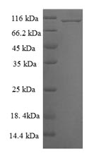 SDS-PAGE- Recombinant protein Human MAPK6