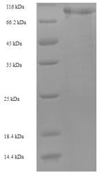 (Tris-Glycine gel) Discontinuous SDS-PAGE (reduced) with 5% enrichment gel and 15% separation gel. (Tris-Glycine gel) Discontinuous SDS-PAGE (reduced) with 5% enrichment gel and 15% separation gel.