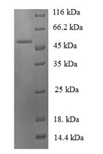 (Tris-Glycine gel) Discontinuous SDS-PAGE (reduced) with 5% enrichment gel and 15% separation gel.