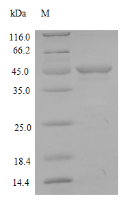 (Tris-Glycine gel) Discontinuous SDS-PAGE (reduced) with 5% enrichment gel and 15% separation gel. (Tris-Glycine gel) Discontinuous SDS-PAGE (reduced) with 5% enrichment gel and 15% separation gel.